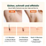 permanent hair reduction